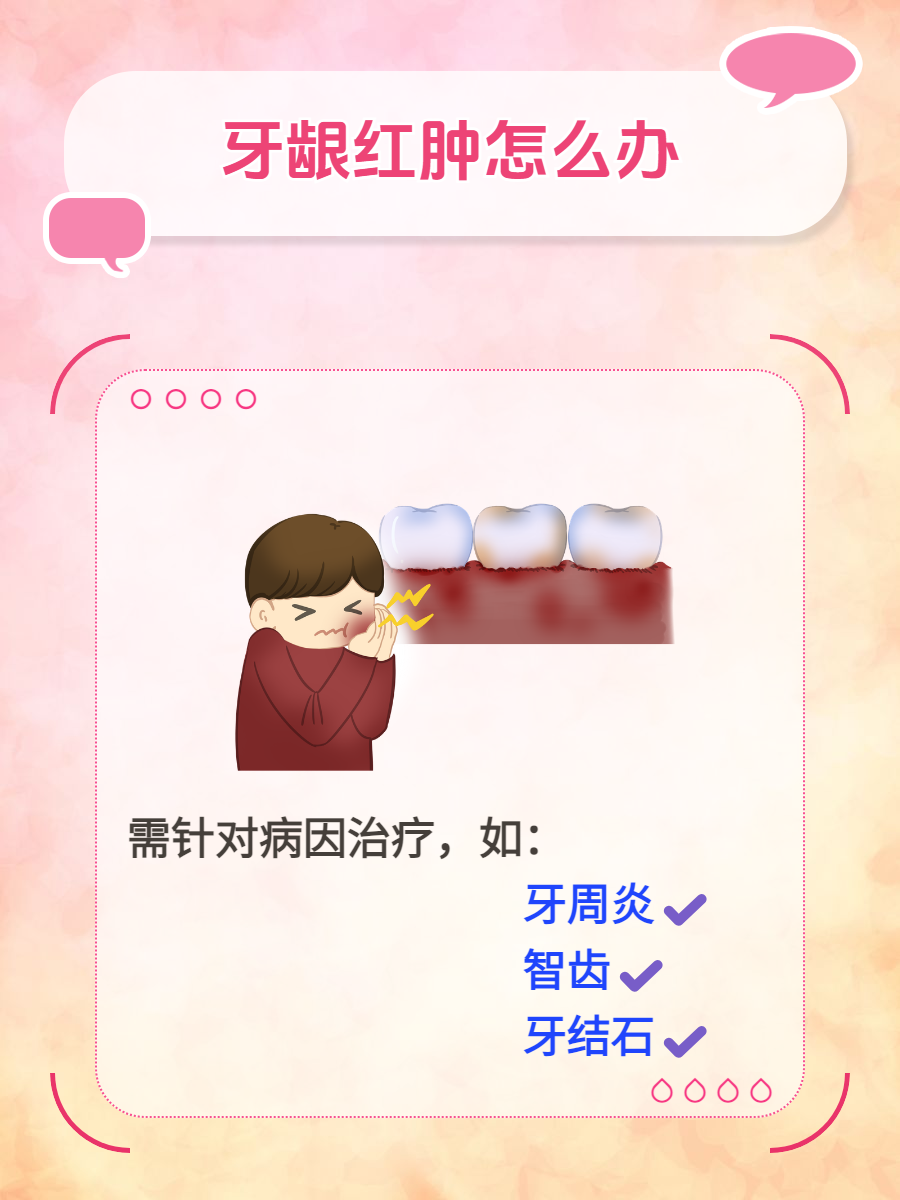牙龈肿痛是什么原因引起的