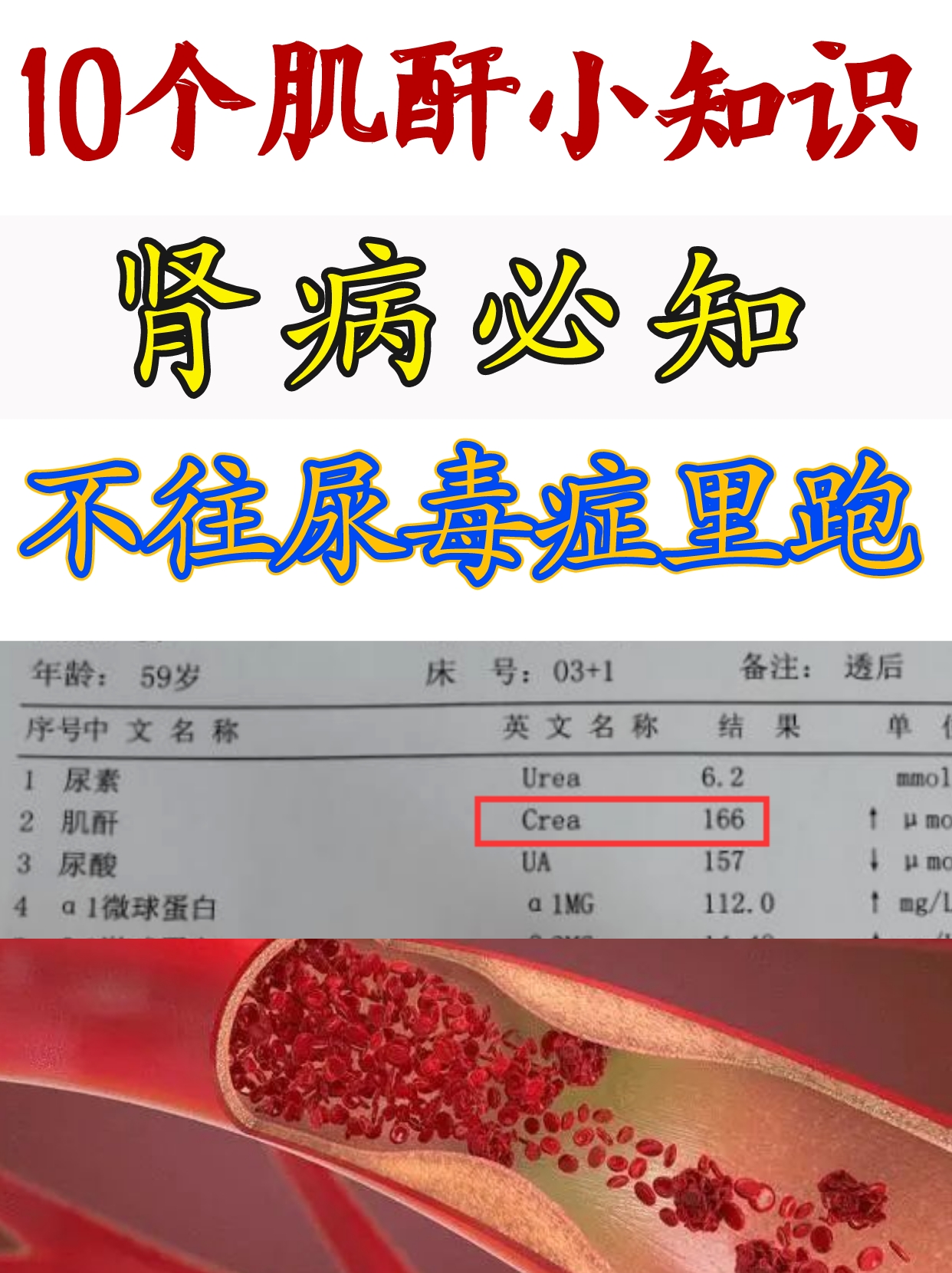 正常人怎么预防尿毒症
