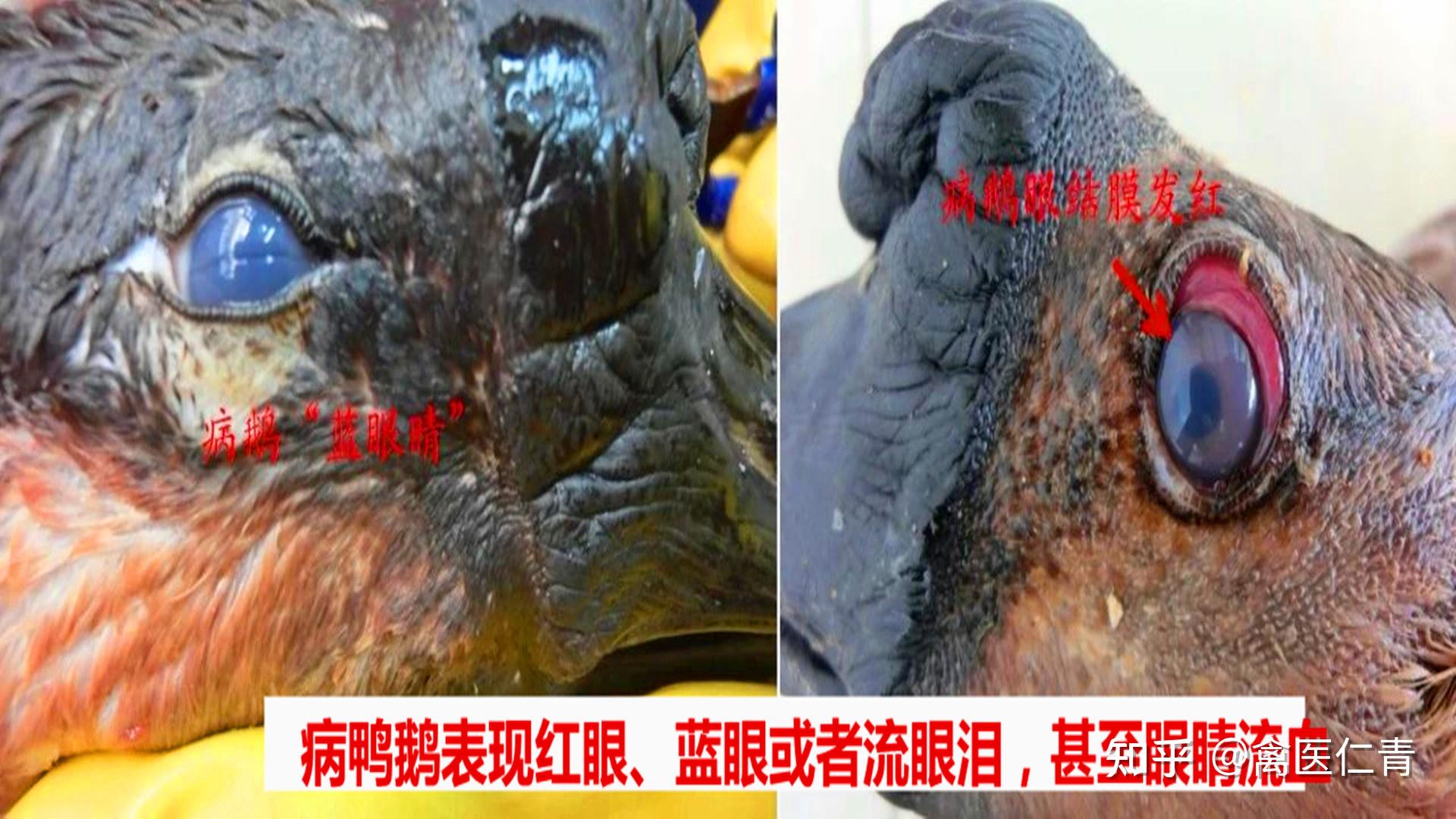 得了禽流感都有什么症状