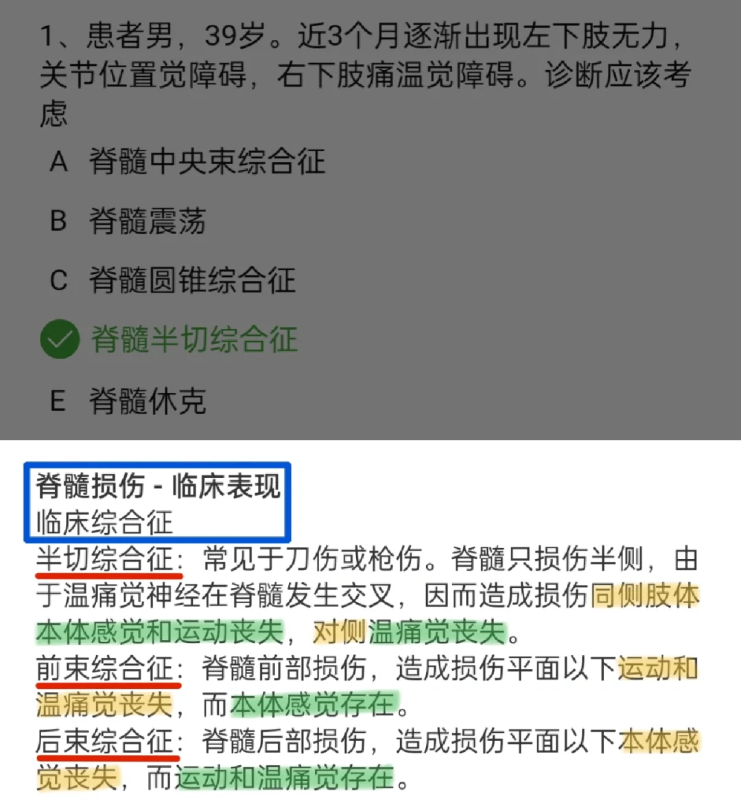 脊髓半切综合征