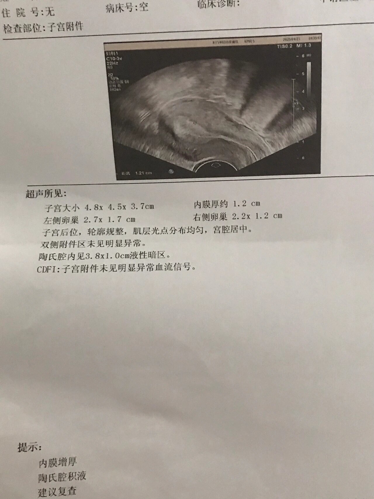 盆腔积液1.5cm严重吗?