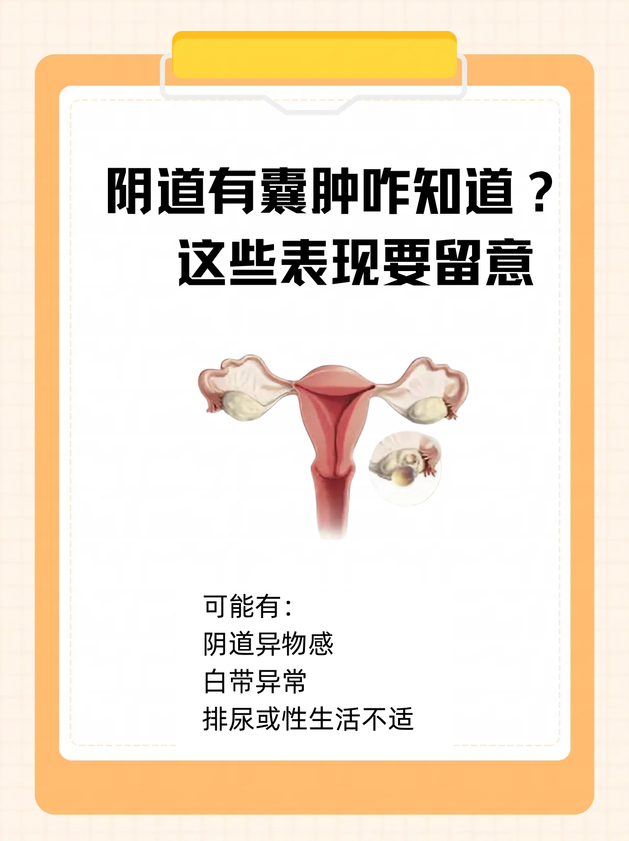 宫颈纳氏囊肿要治疗吗?