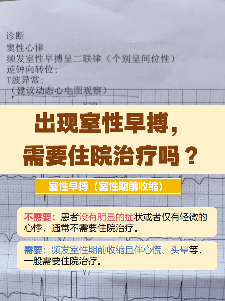 频发室性早搏的危害