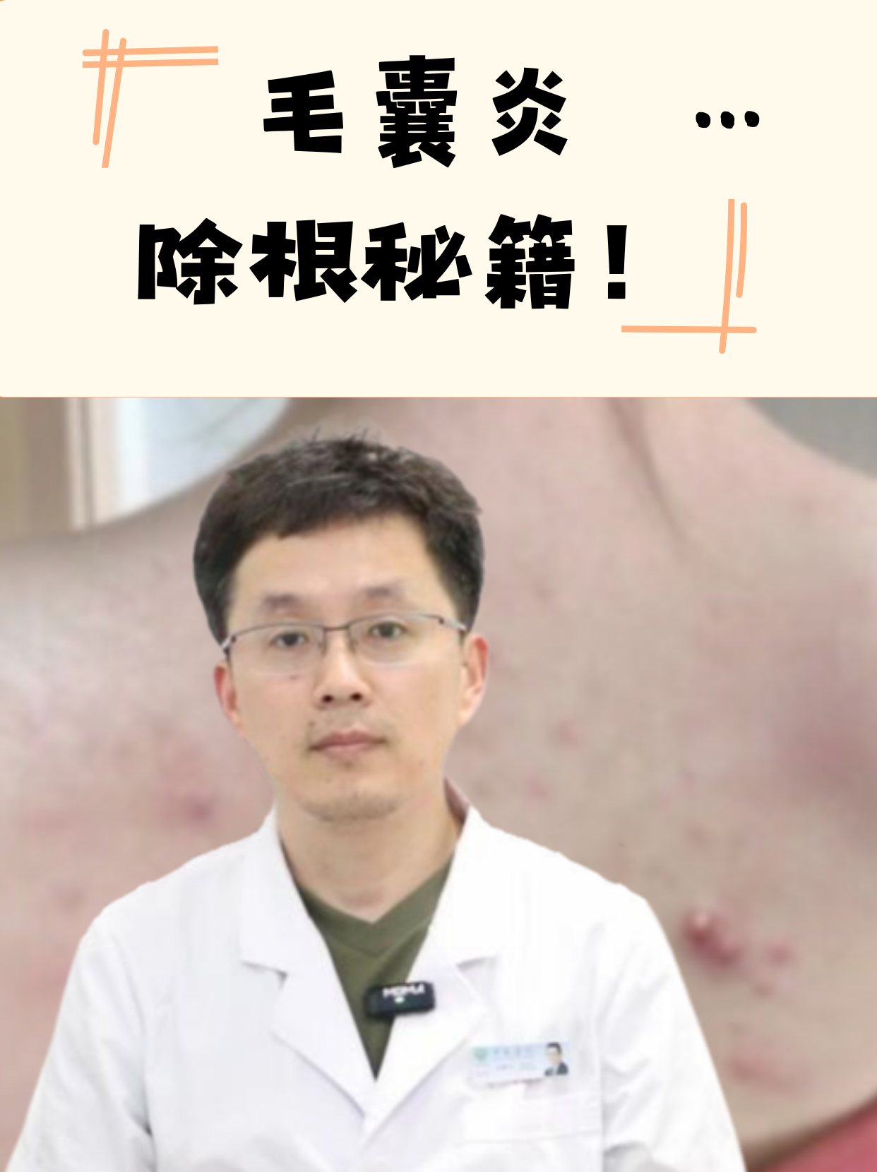 毛囊炎是怎么引起的?