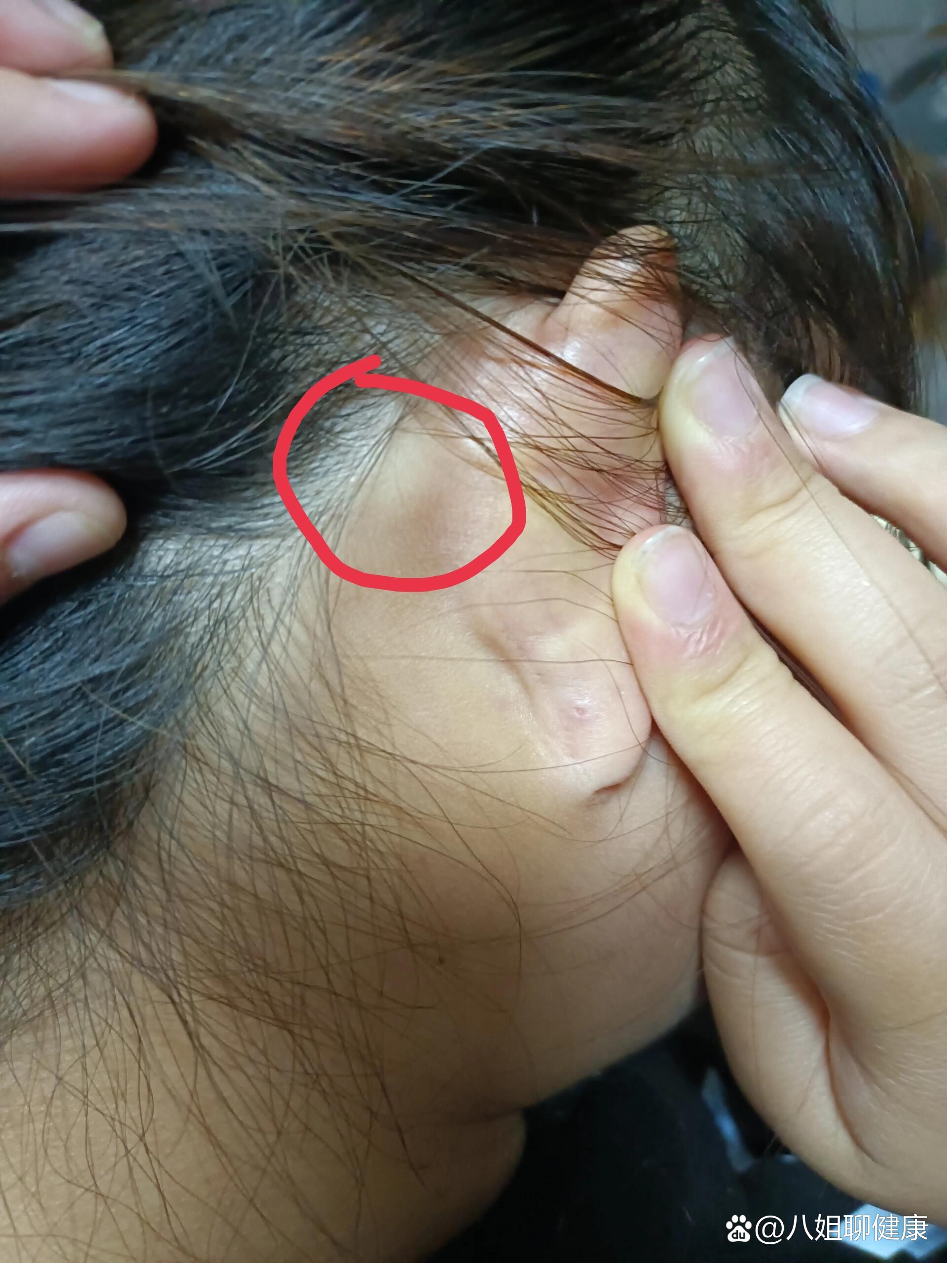 耳朵后面一阵一阵的痛