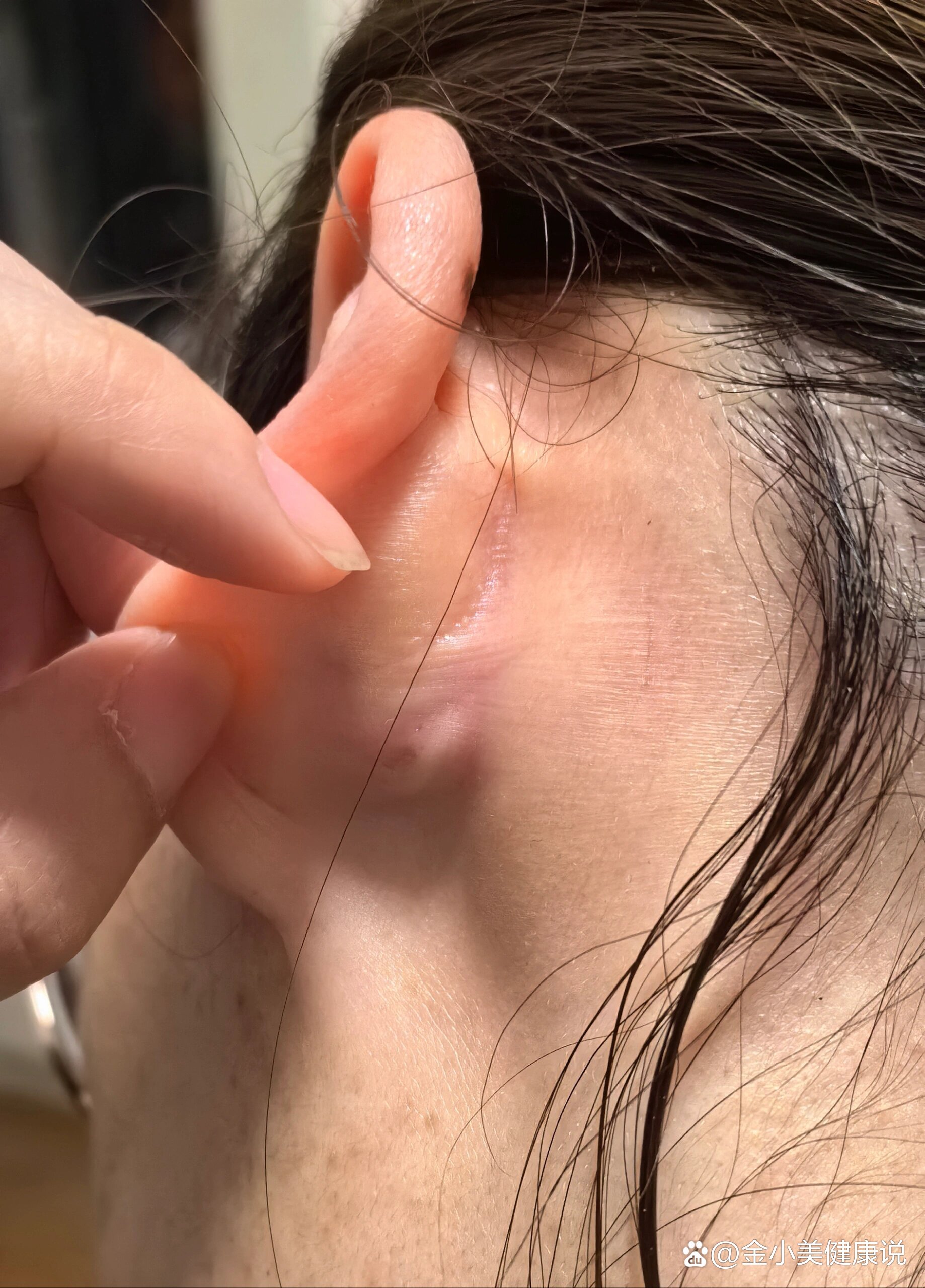 耳朵后面一阵一阵的痛