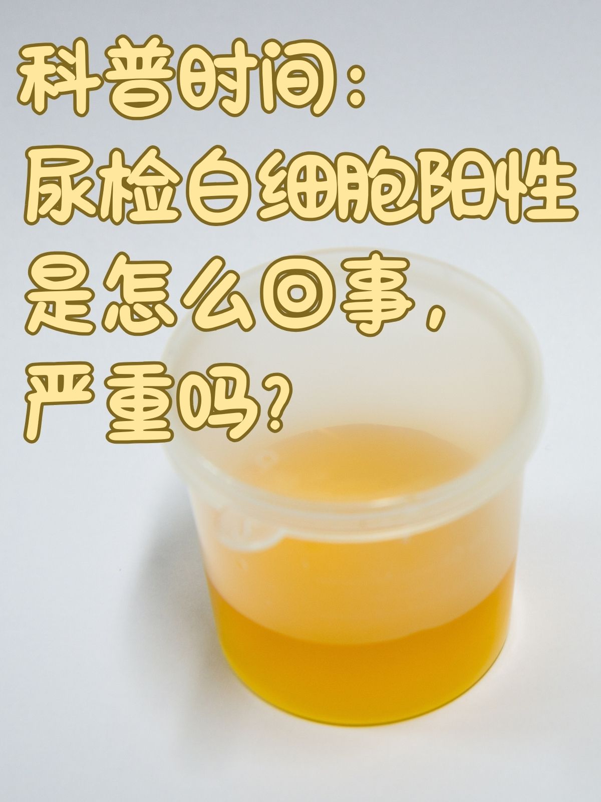 尿检都检查什么?