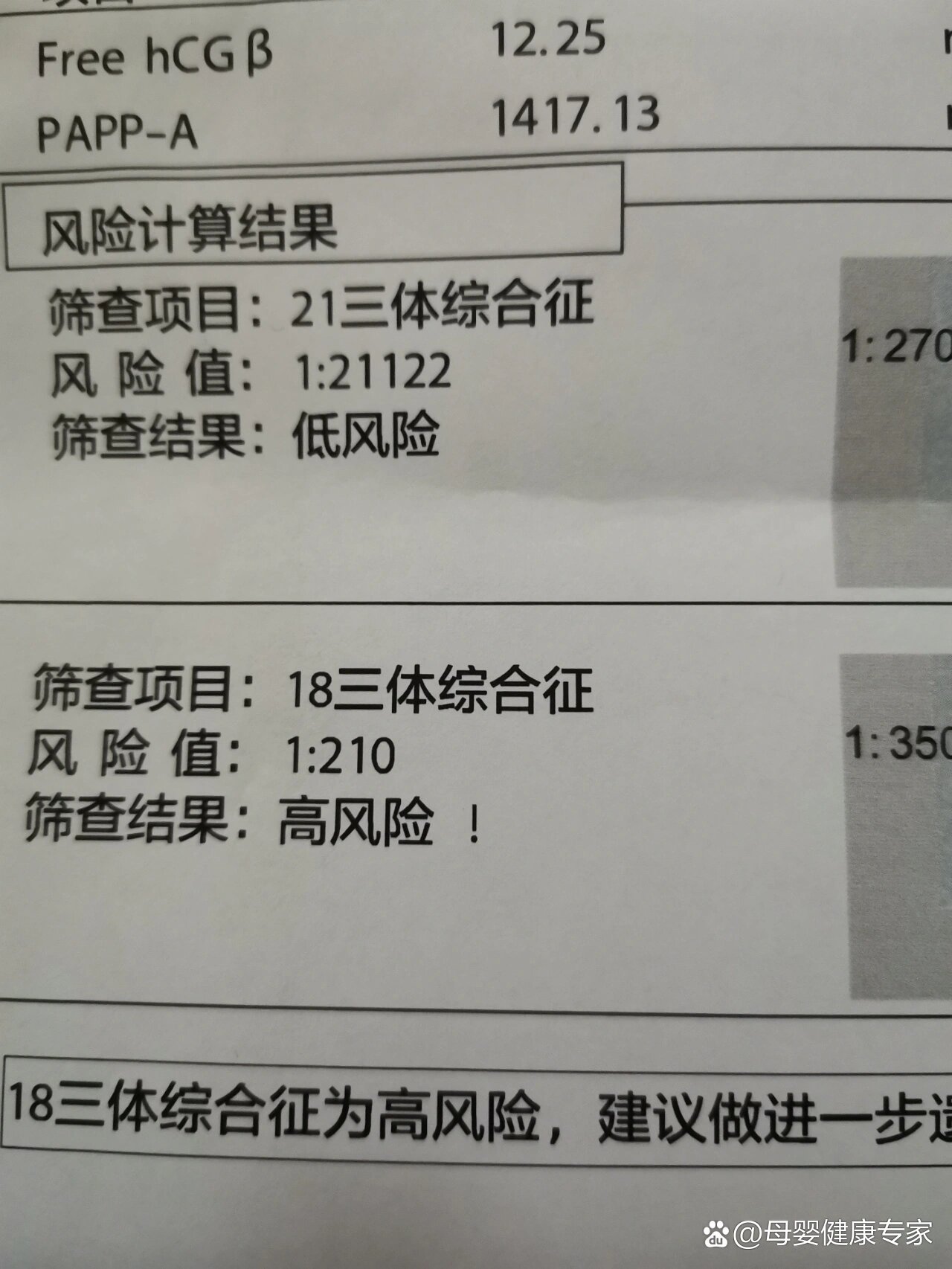 18三体综合征