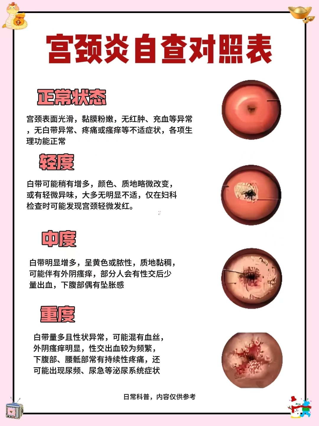 宫颈糜烂,白带带血,其他地方都很正常