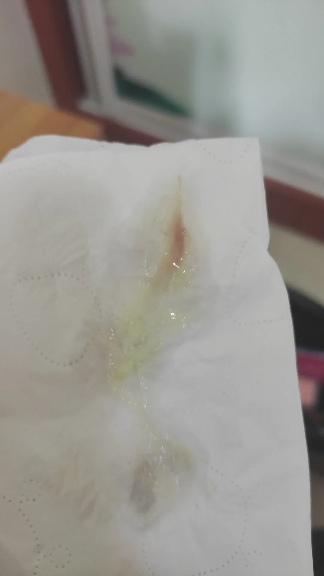 排卵期白带有血正常吗