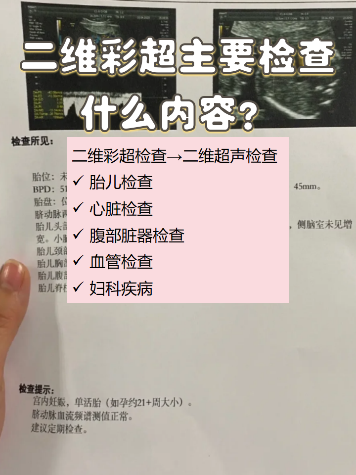 彩超可以查什么