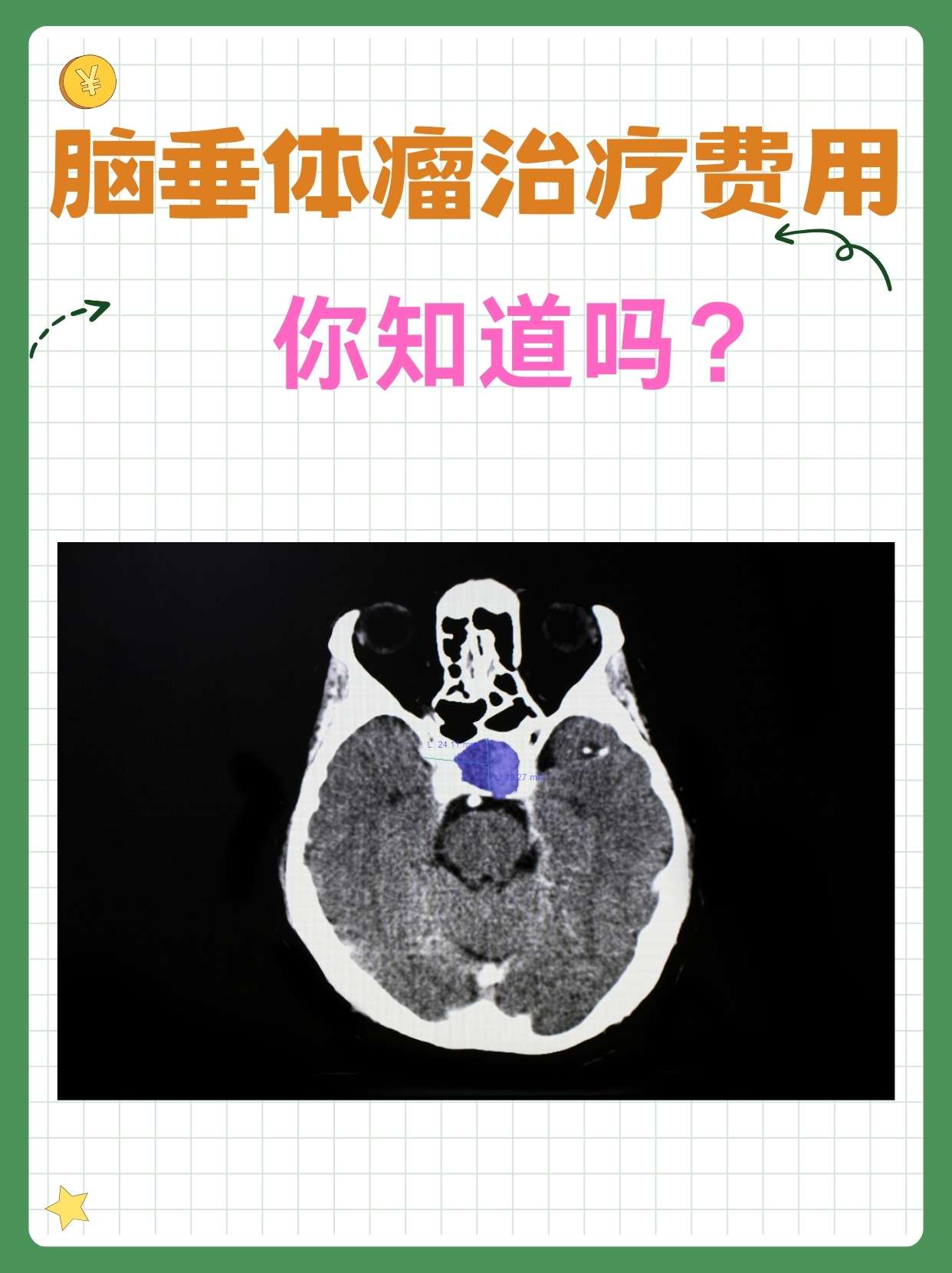 得垂体微腺瘤能要孩子吗