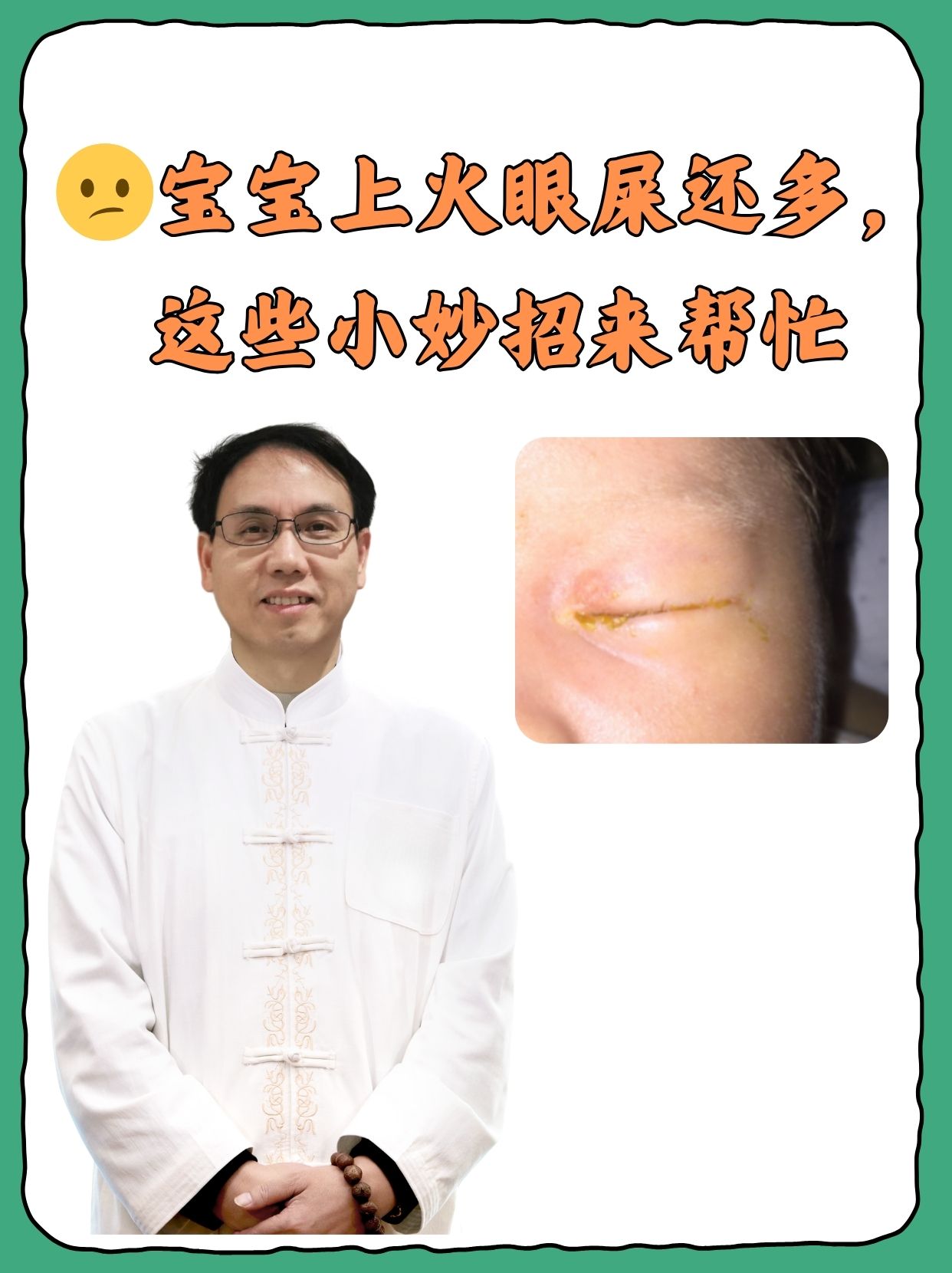 眼睛红有眼屎怎么办