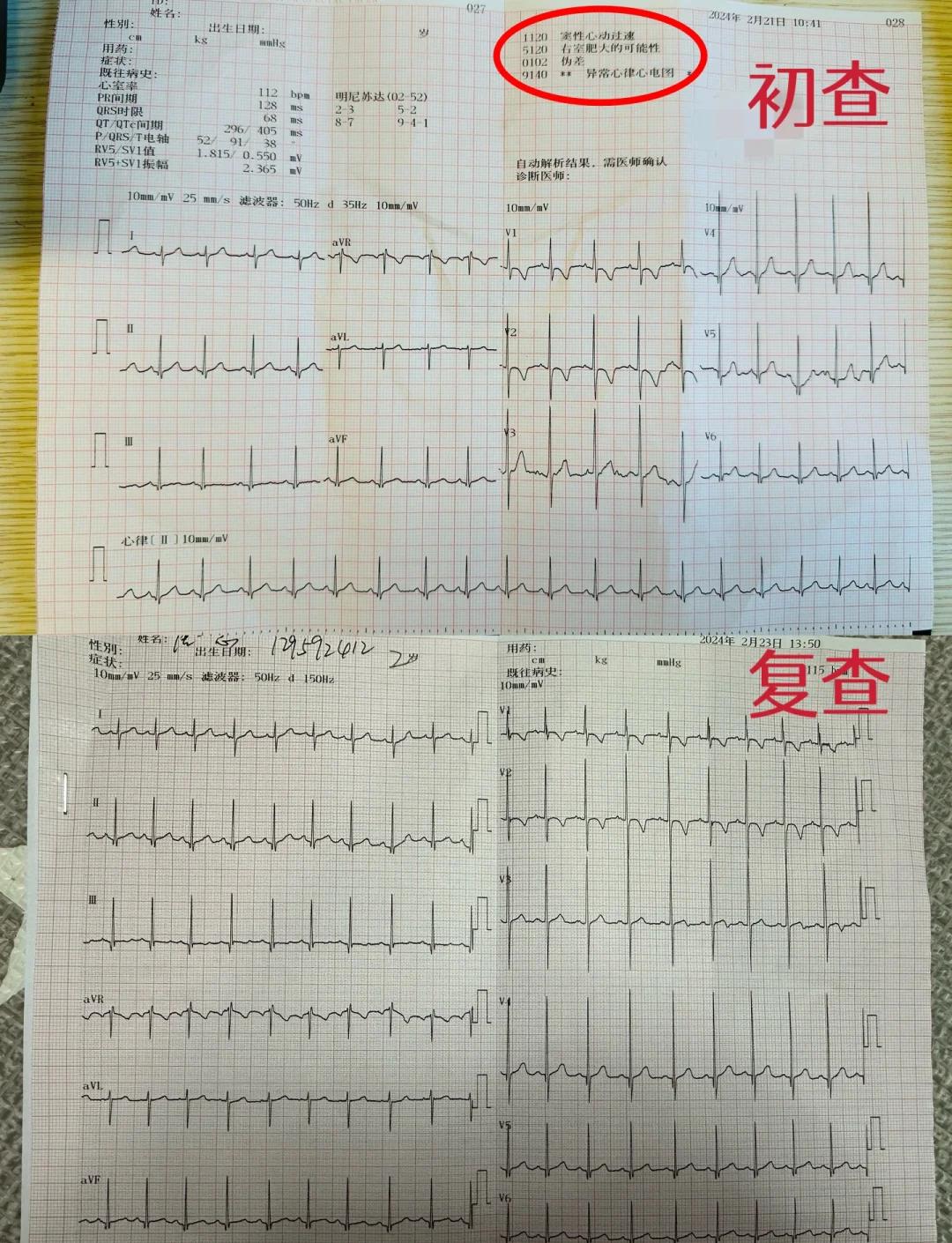 窦性心律过快怎么办