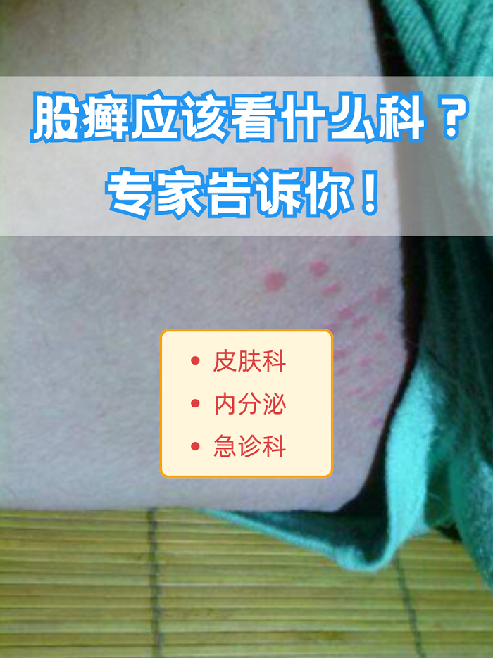 股癣是什么病?