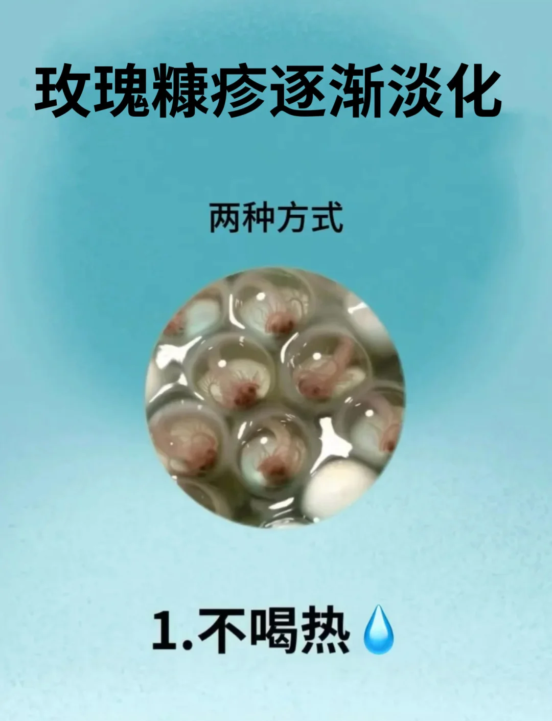 玫瑰糠疹是什么原因引起的