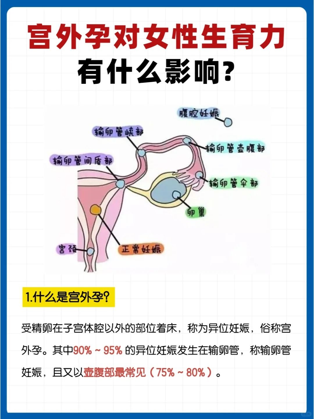 什么原因引起宫外孕