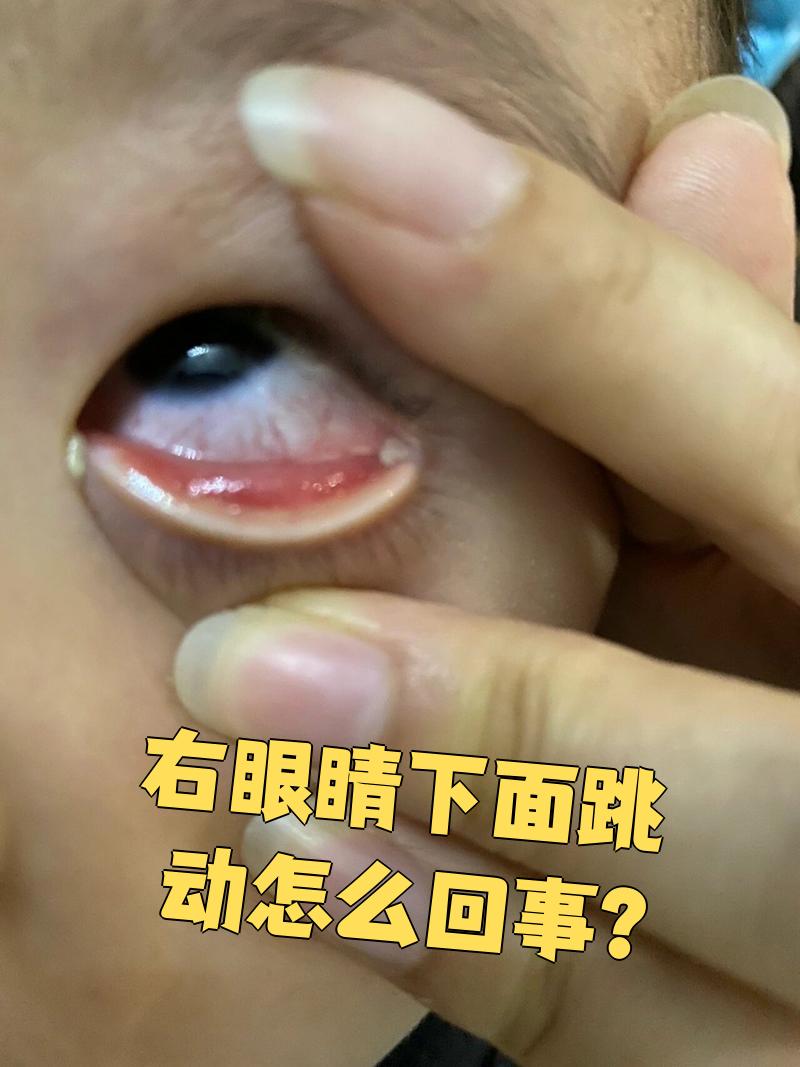 外眼角疼按压眨眼涨疼