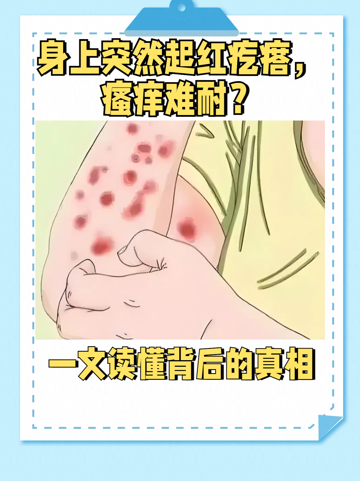 全身皮肤瘙痒起红疙瘩是怎么回事