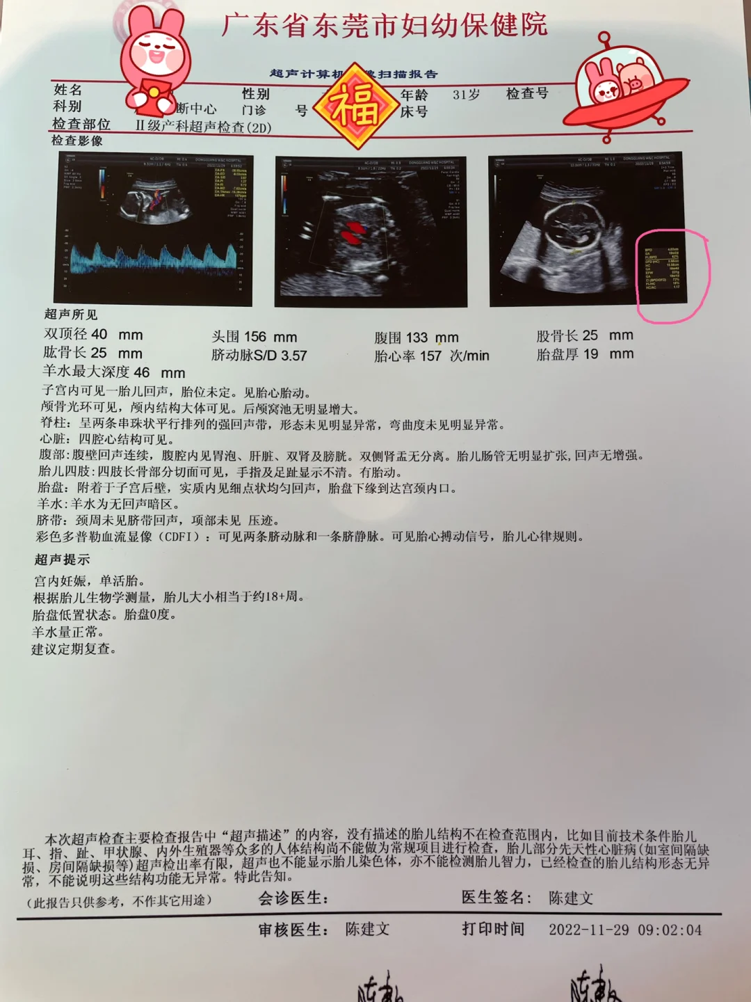 吃完饭还能做彩超吗