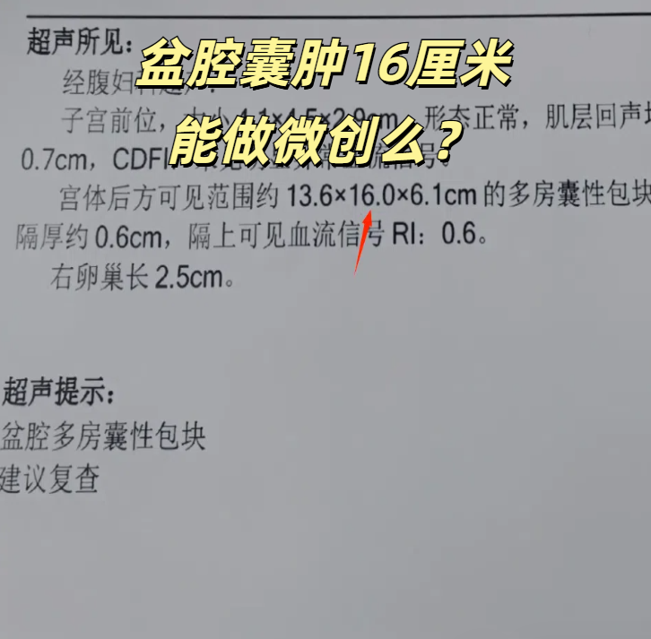 卵巢囊肿可以性生活吗?