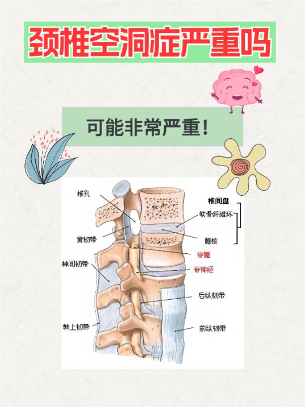 颈椎病是怎么导致的
