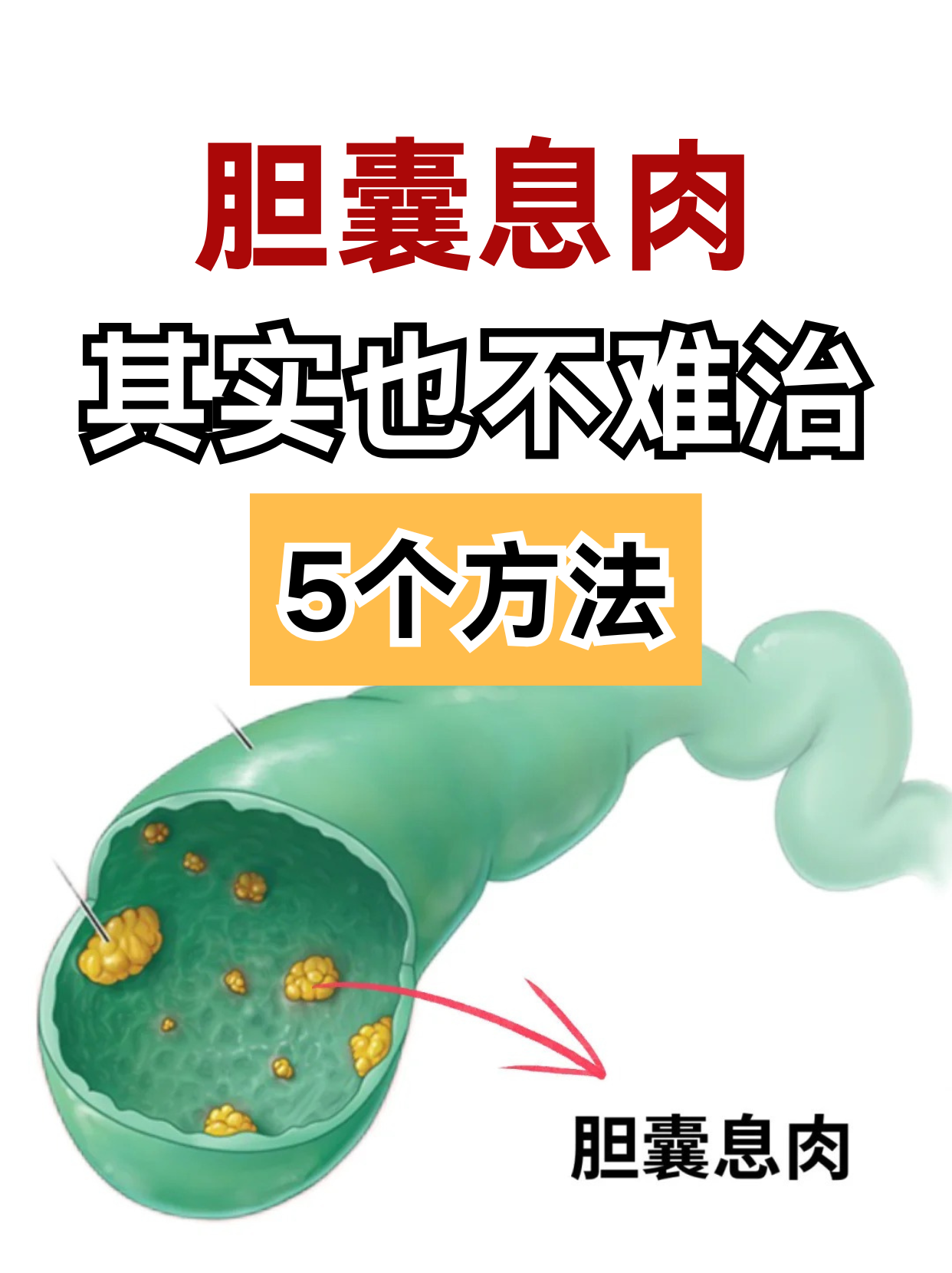 坚芳春 第2页