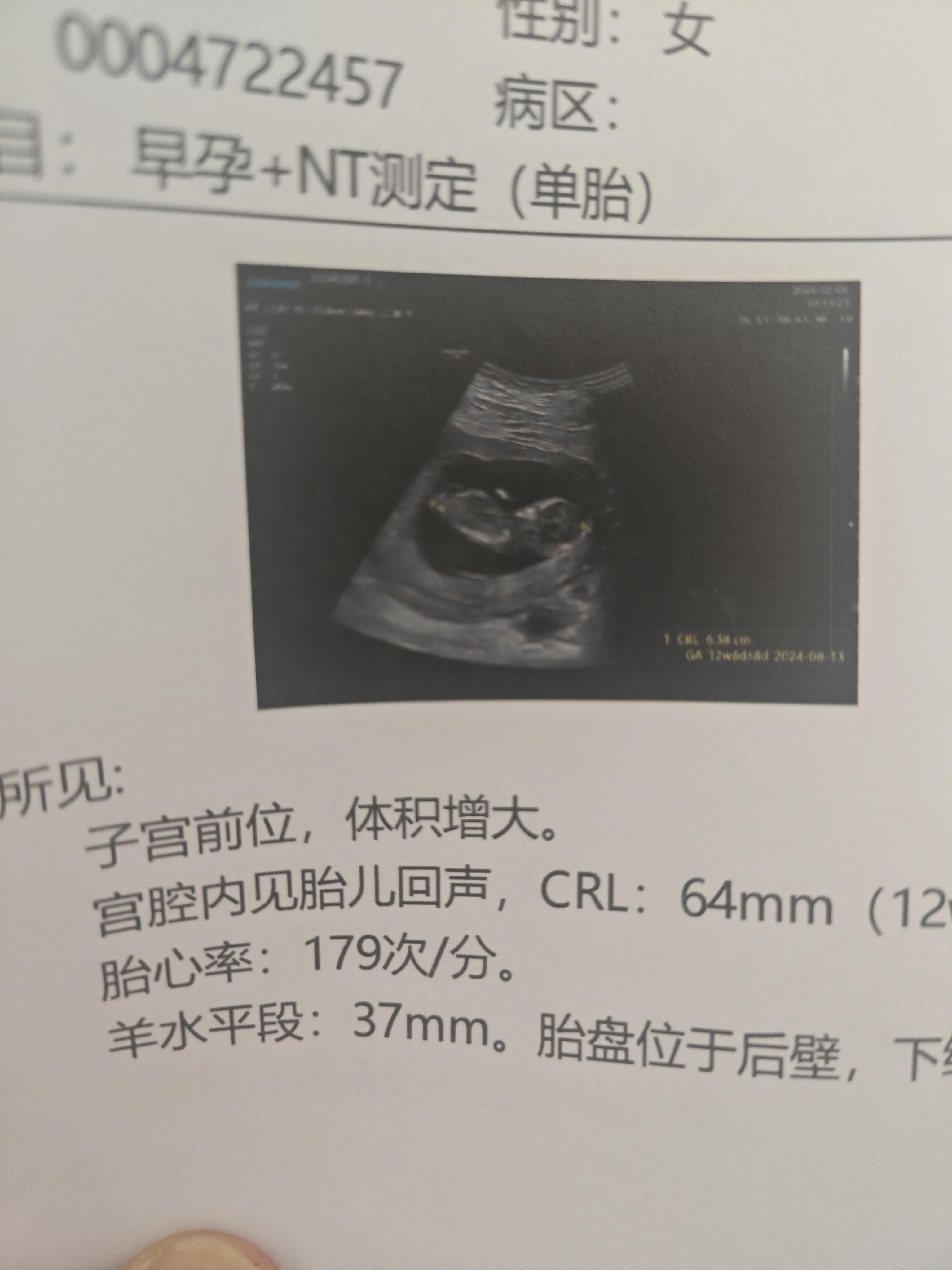 13周胎儿大小