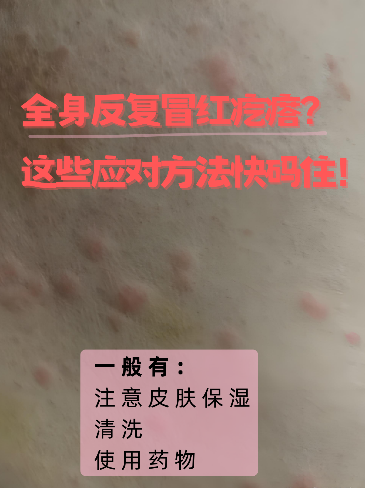全身起小红疙瘩怎么办?