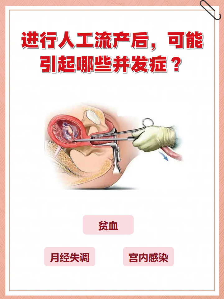 流产有什么症状?