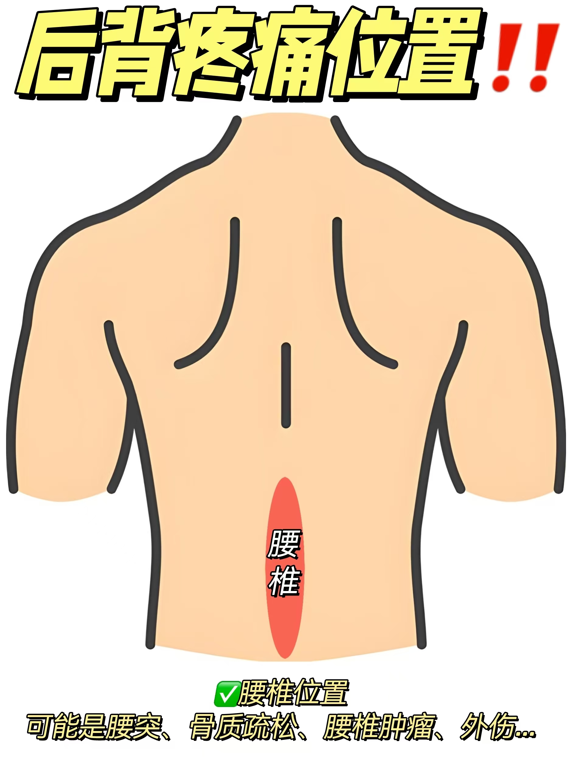 后背痛是什么病的先兆