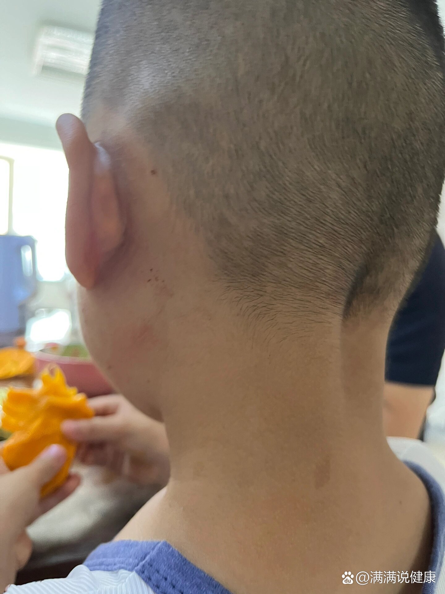 三线炎有哪些症状