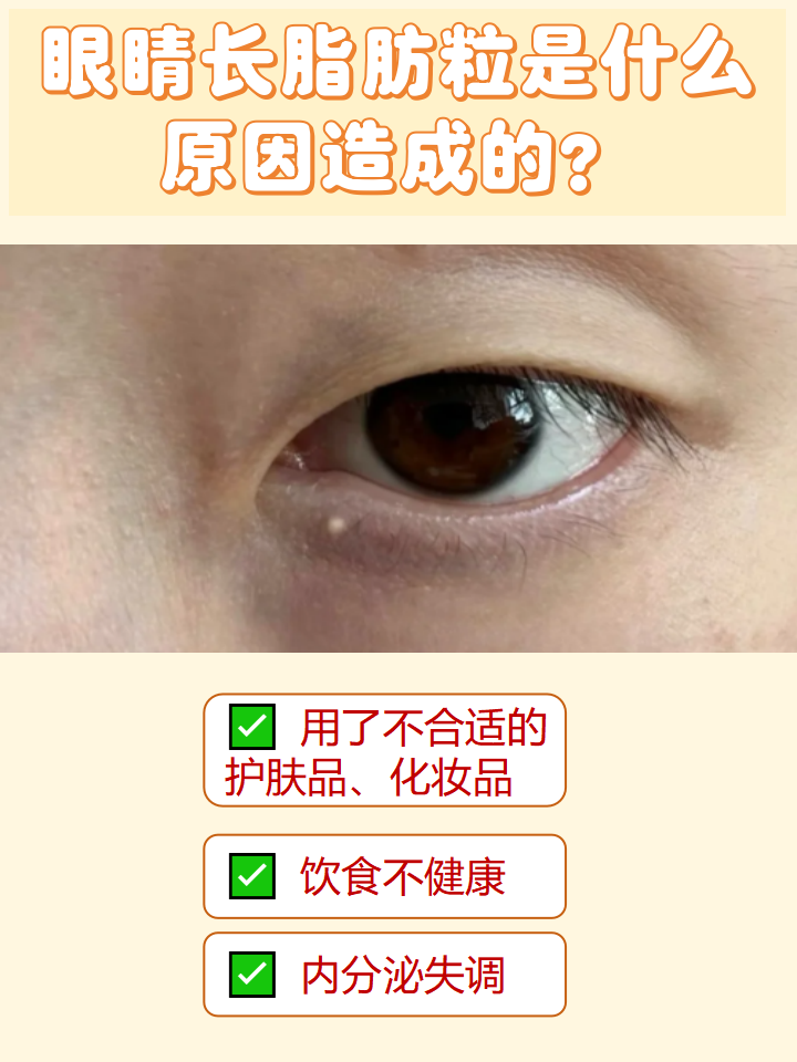 眼睛周围长脂肪粒是什么原因