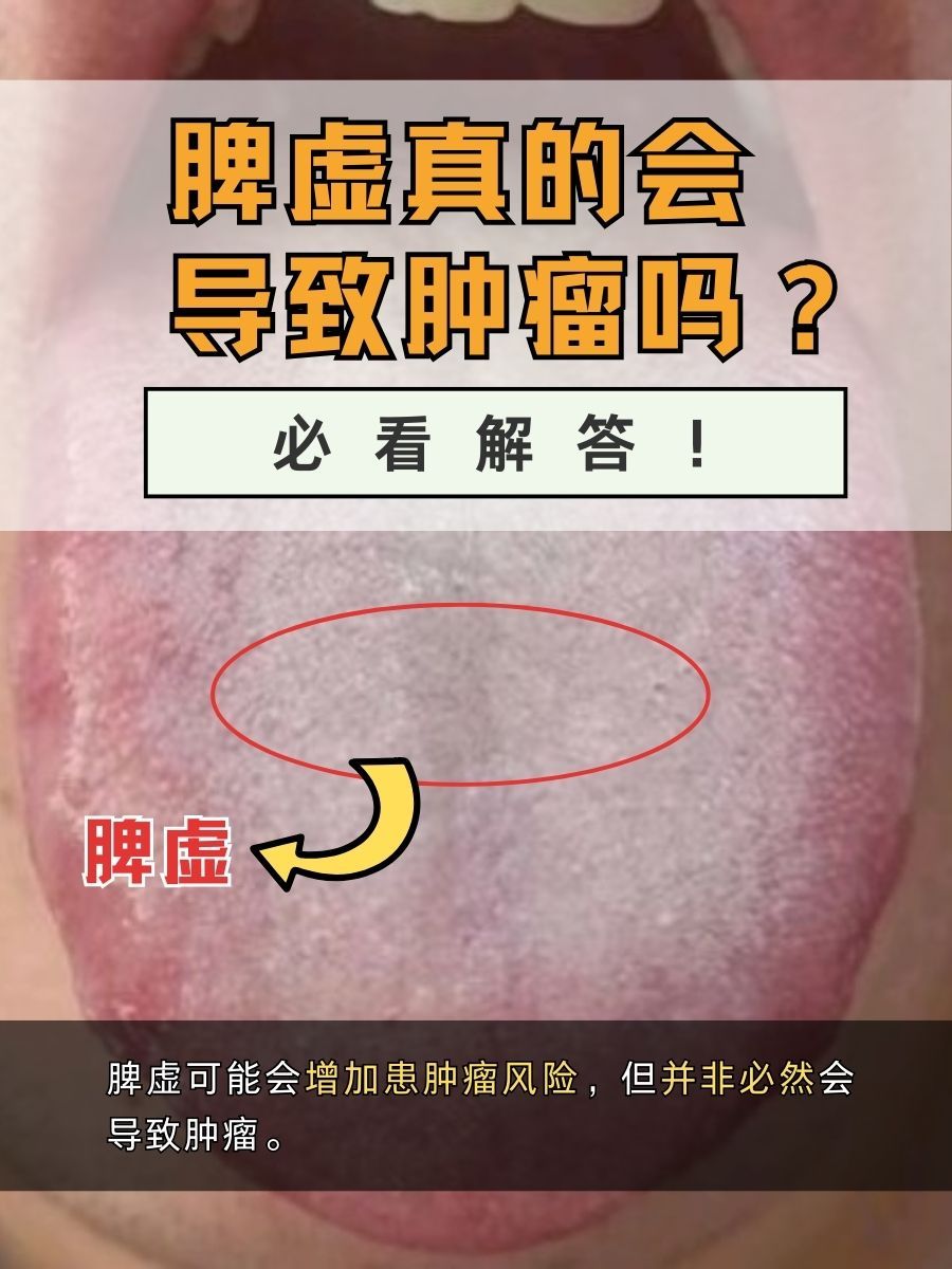 ldquo脾虚rdquo的症状表现有哪些?