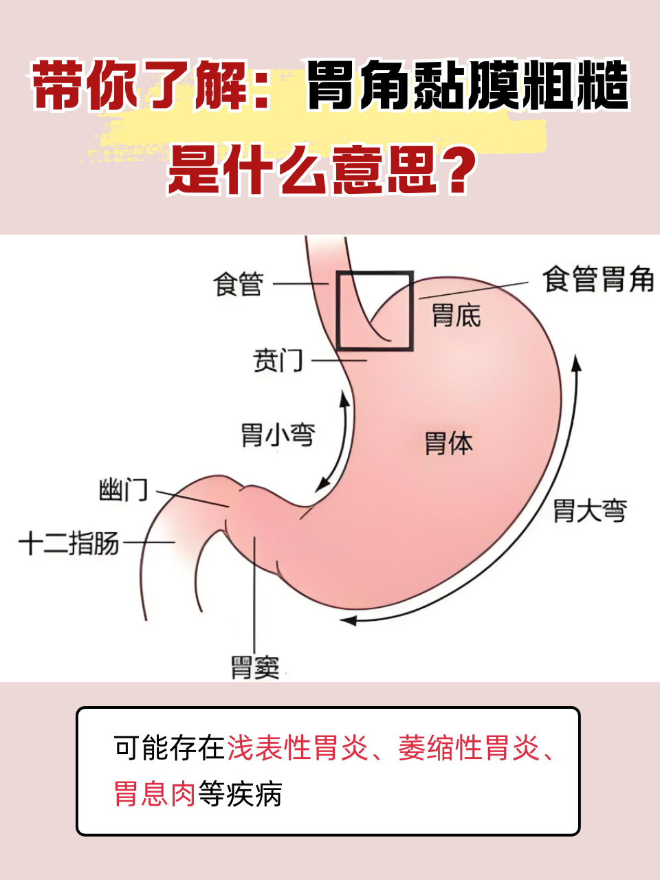 胃部灼热感是怎么回事