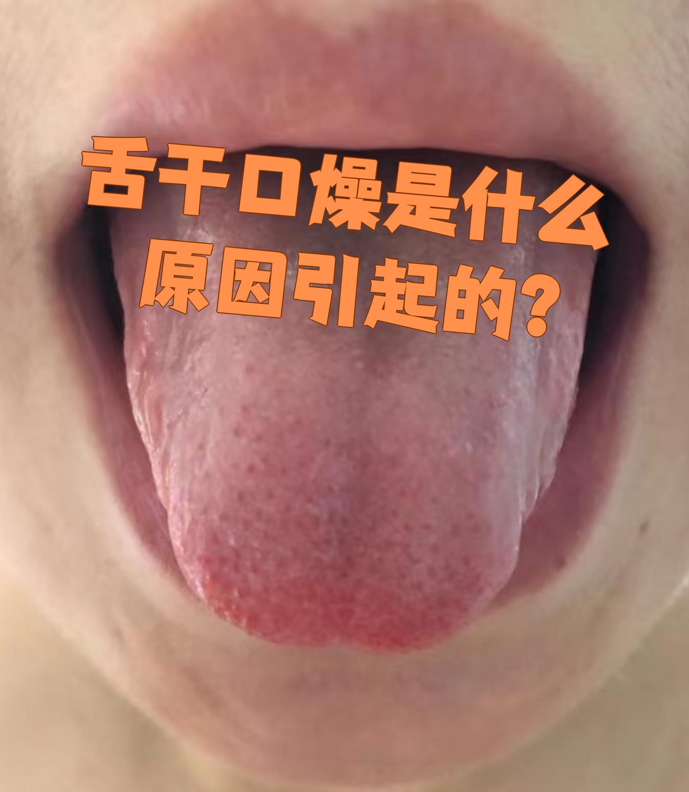 总是感觉口干舌燥是什么原因