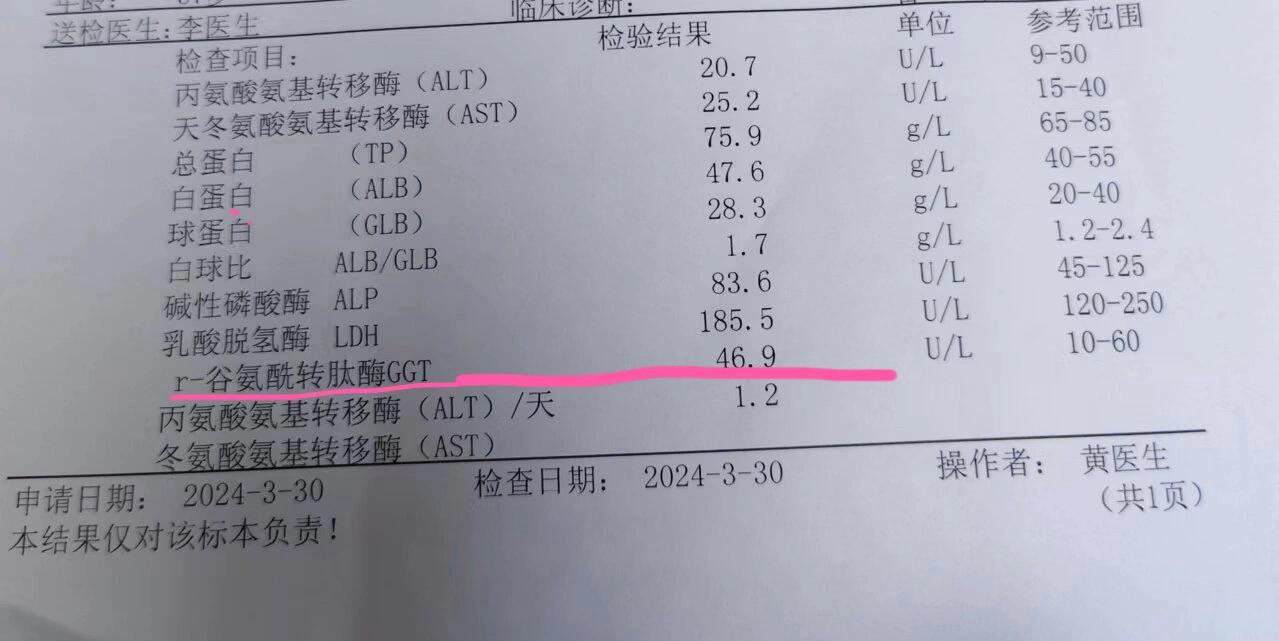 谷酰转肽酶高是肝癌吗?