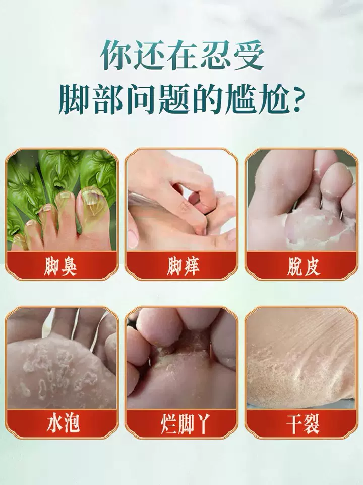 脚脱皮,可以怎么治疗