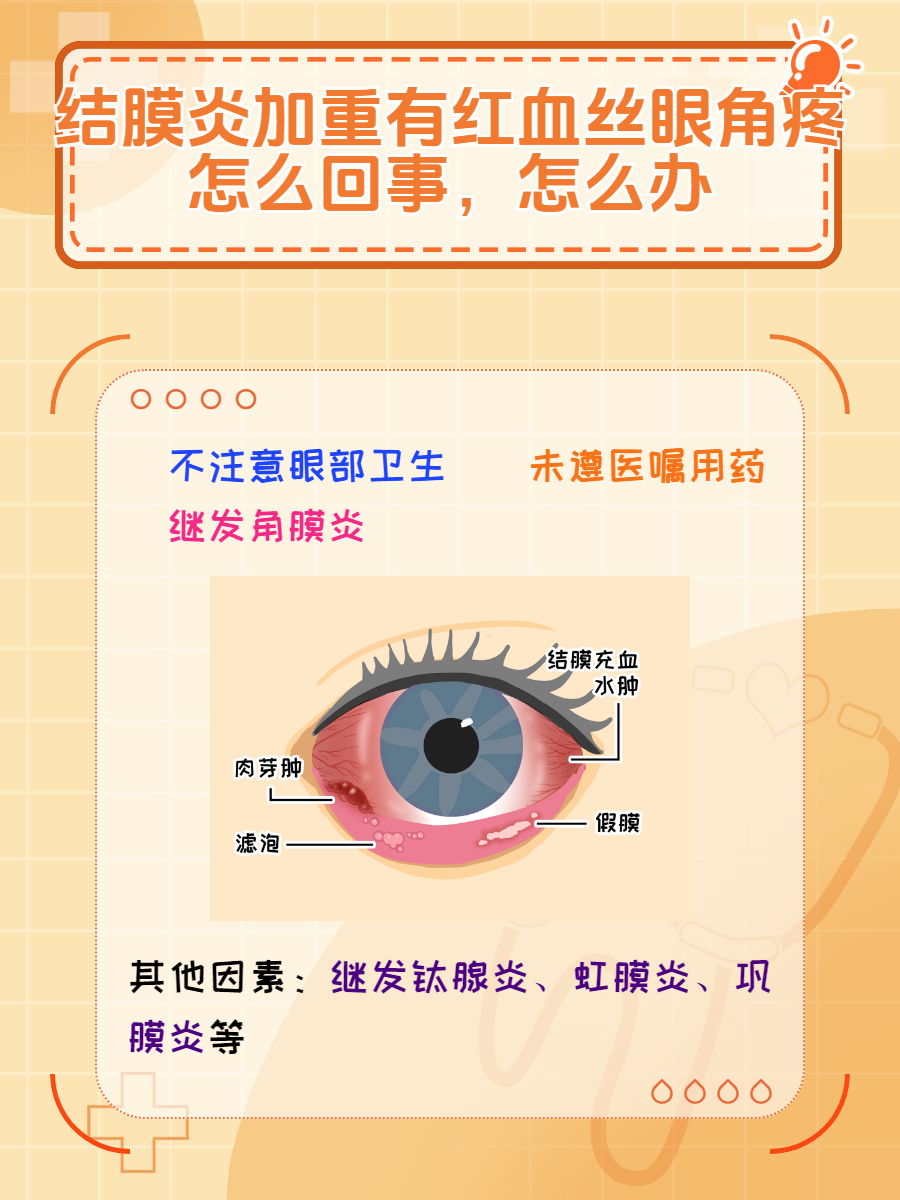眼睛里有血丝是怎么回事?