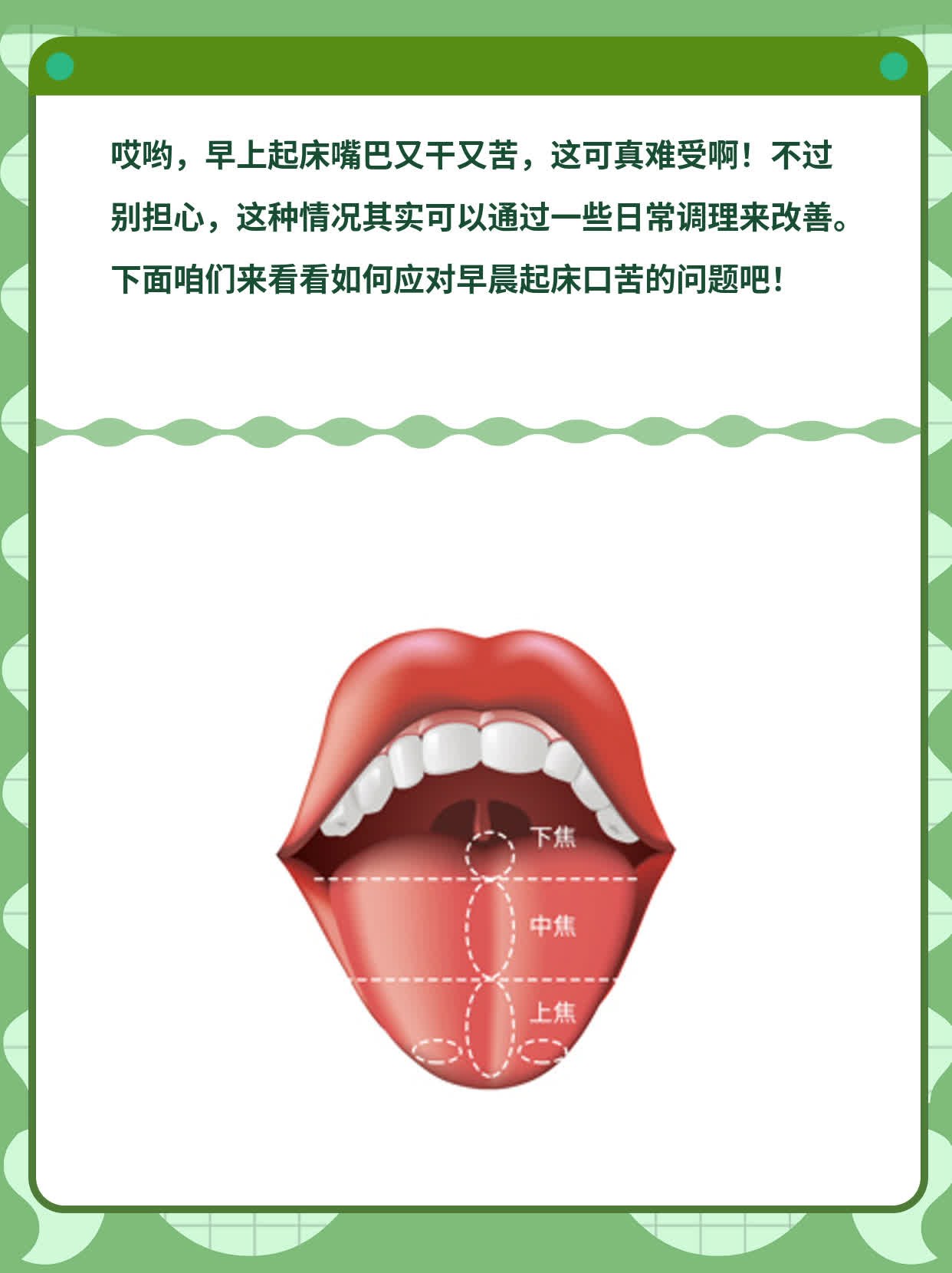 早晨起来口苦是什么原因