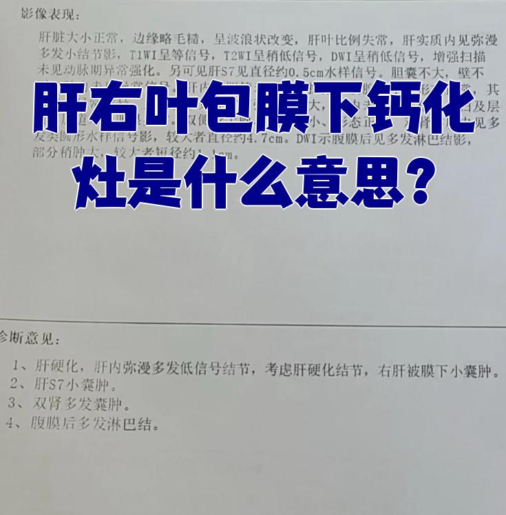肝钙化点什么意思