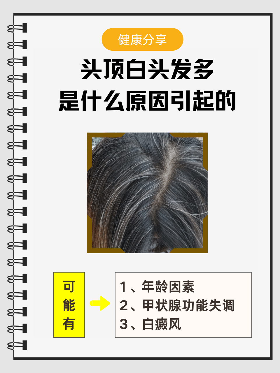 白发多是什么原因引起的