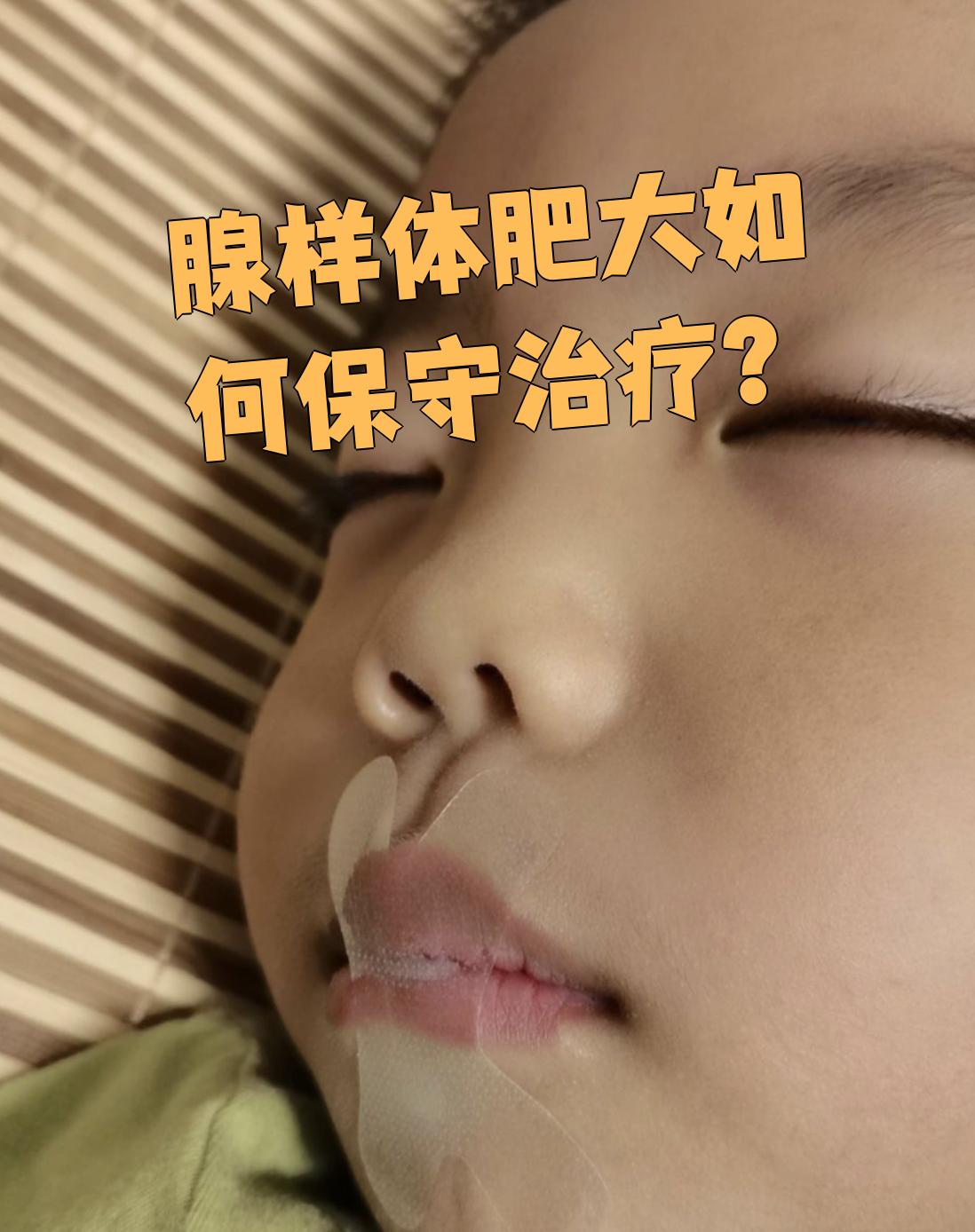 腺样体肥大有哪些表现