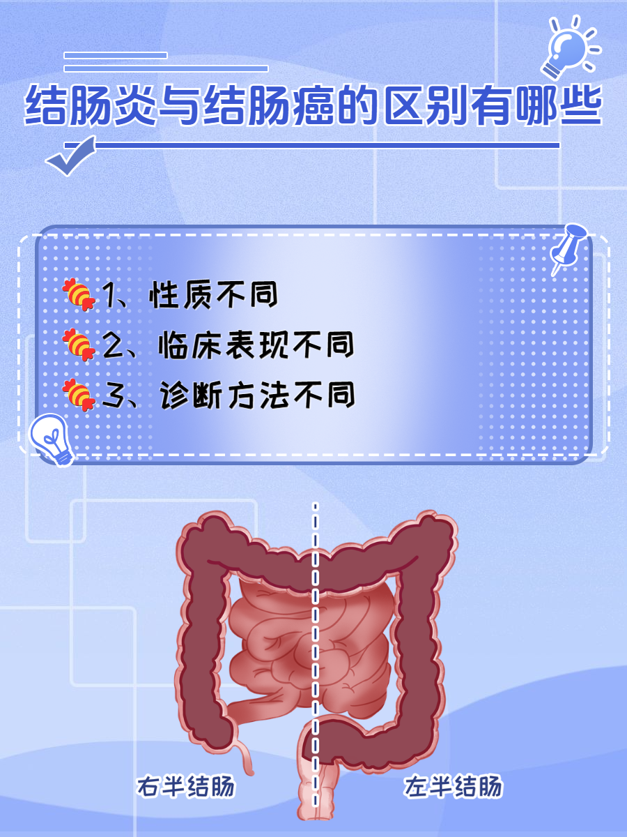 结肠癌由什么原因引起的