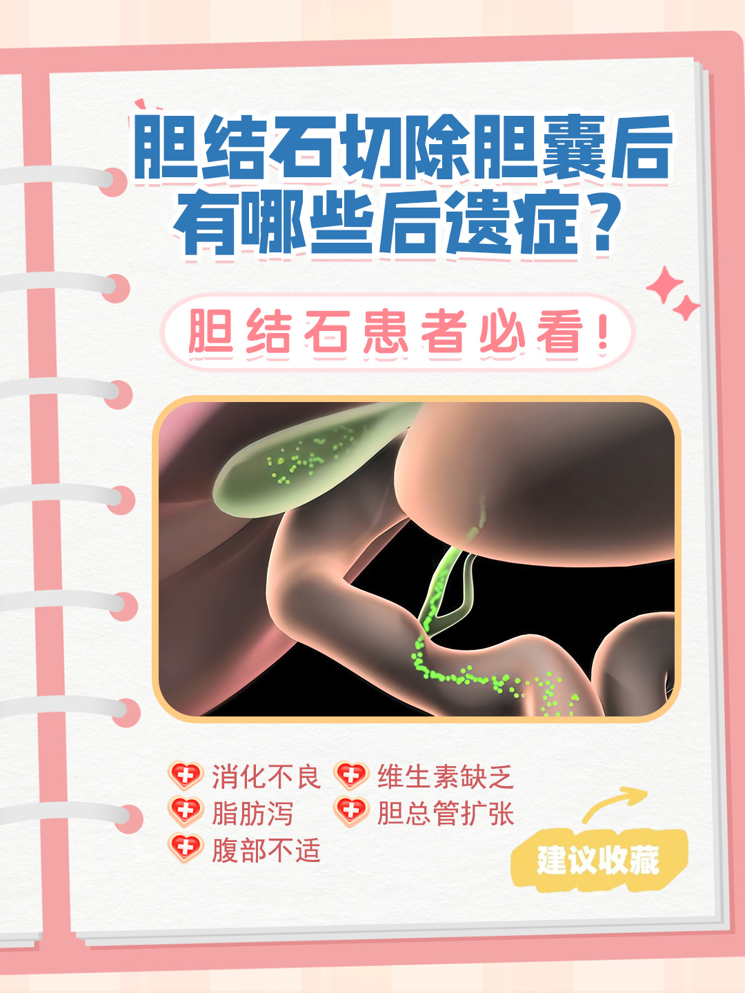 胆囊切除对人体有什么影响
