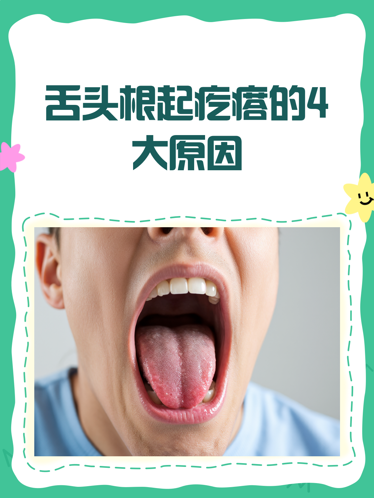 舌根有疙瘩,怎么回事