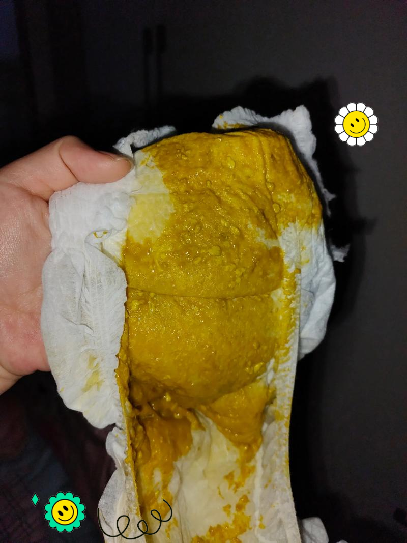 拉屎臭是什么原因???
