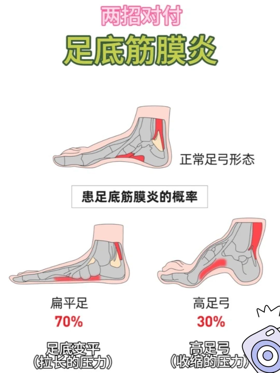 脚底板疼怎么治疗