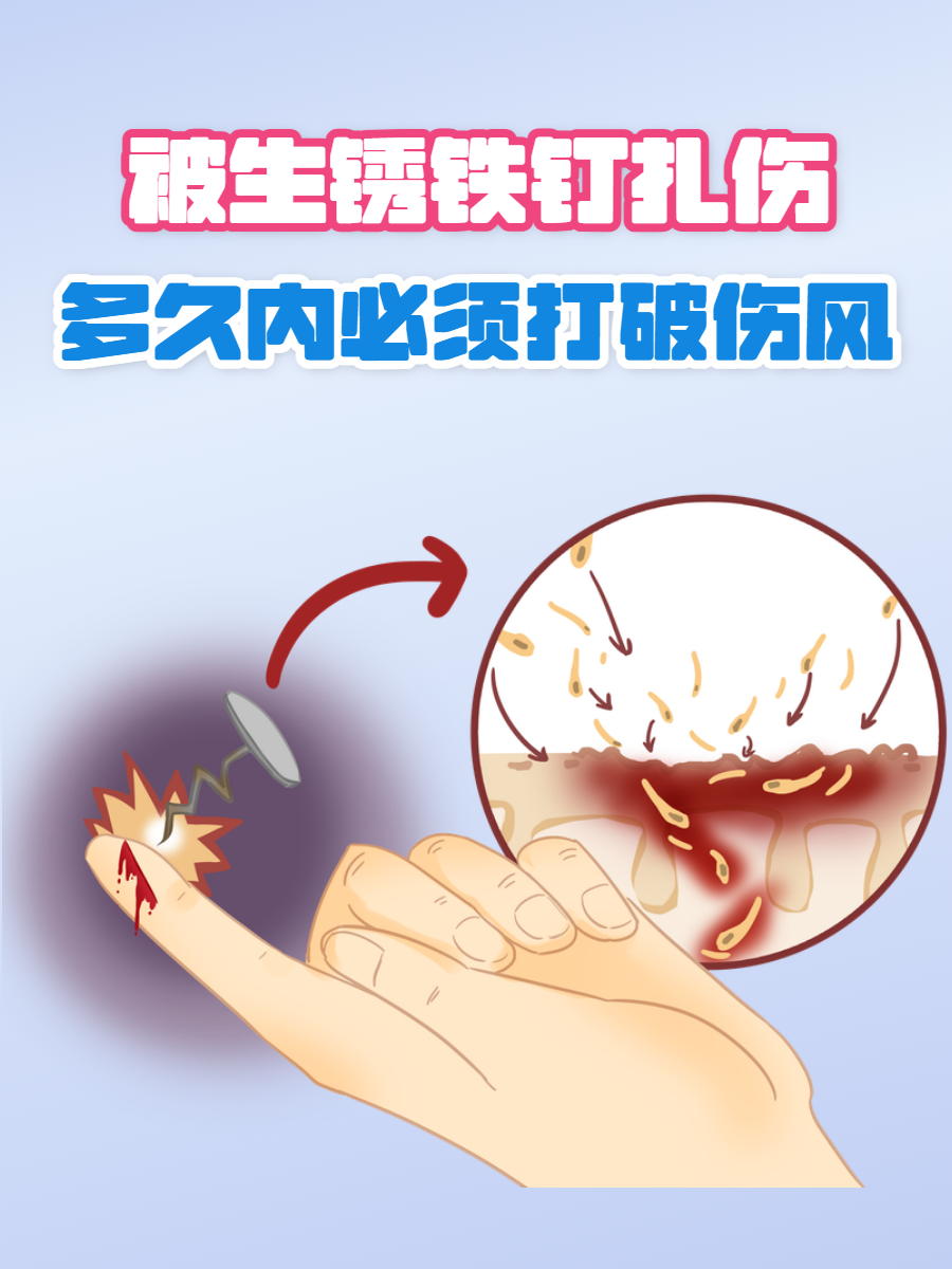 被钉子扎了破伤风概率高吗