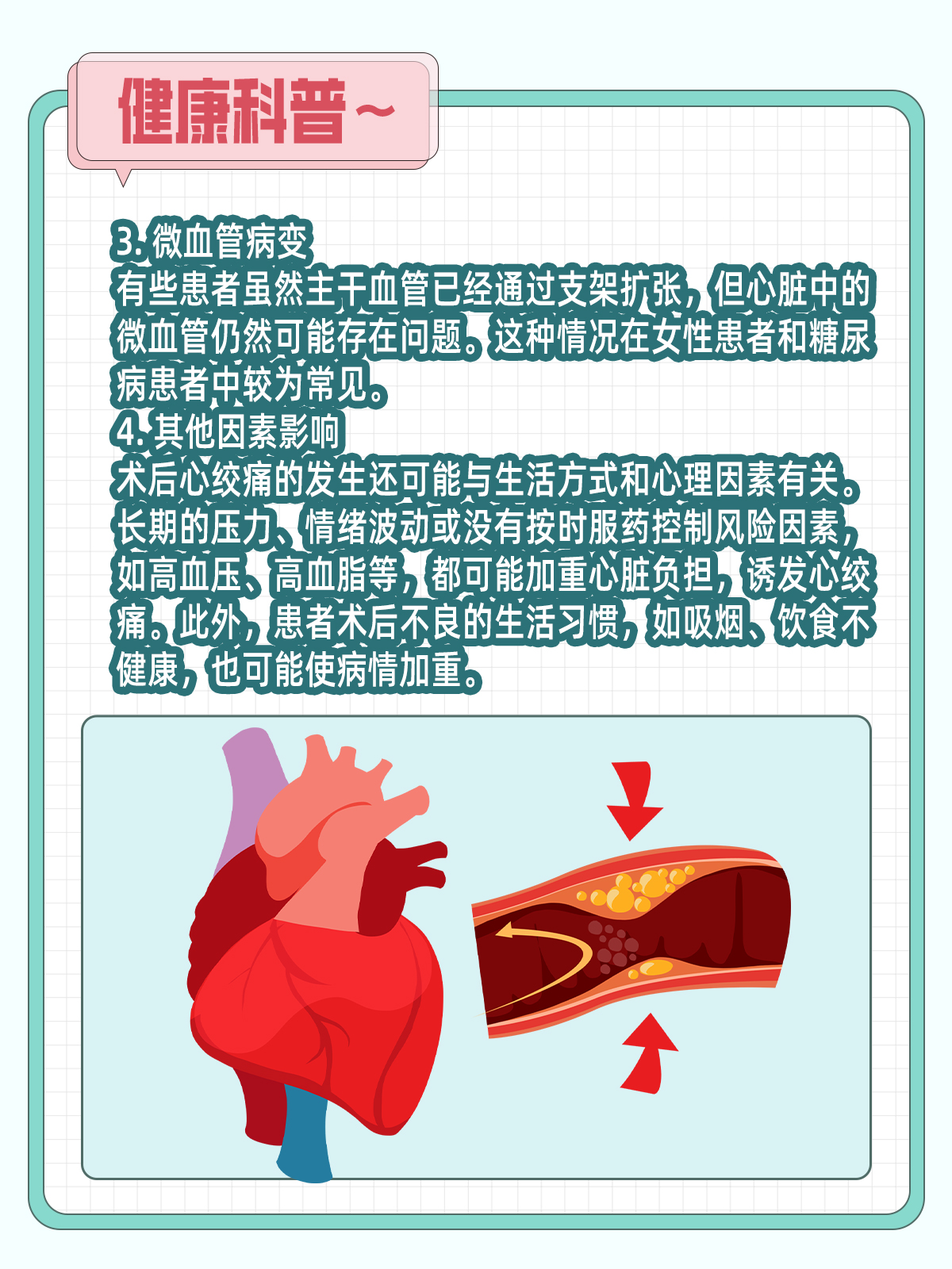 如何缓解心绞痛